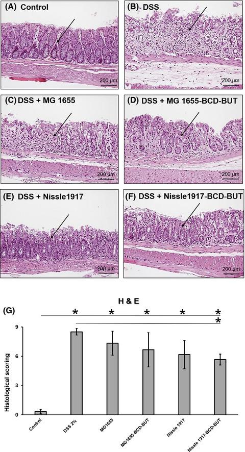 Physiological activity of E. coli engineered to produce butyric acid