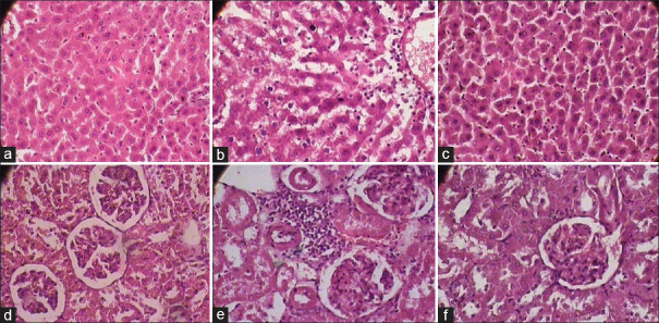 Evaluation of <i>Punarnavadi Mandura</i> for haematinic activity against mercuric chloride-induced anemia in albino rats.