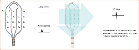 Dynamic High-density Functional Substrate Mapping Improves Outcomes in Ischaemic Ventricular Tachycardia Ablation: Sense Protocol Functional Substrate Mapping and Other Functional Mapping Techniques.