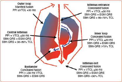 Dynamic High-density Functional Substrate Mapping Improves Outcomes in Ischaemic Ventricular Tachycardia Ablation: Sense Protocol Functional Substrate Mapping and Other Functional Mapping Techniques.