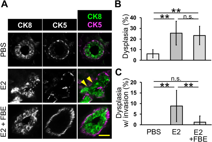 Supplementation with Fermented Barley Extract Prevents Mammary Epithelial Cell Invasion in an Early Breast Cancer Model.