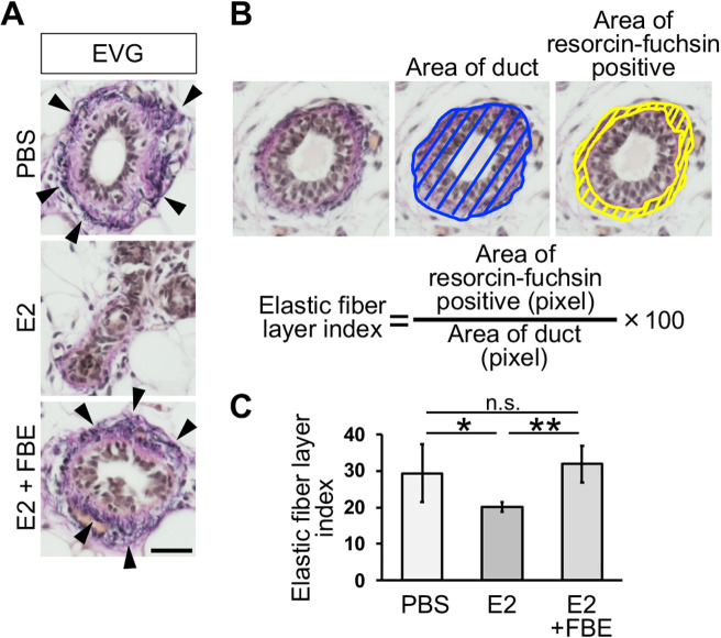 Supplementation with Fermented Barley Extract Prevents Mammary Epithelial Cell Invasion in an Early Breast Cancer Model.