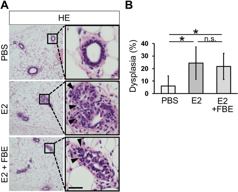 Supplementation with Fermented Barley Extract Prevents Mammary Epithelial Cell Invasion in an Early Breast Cancer Model.