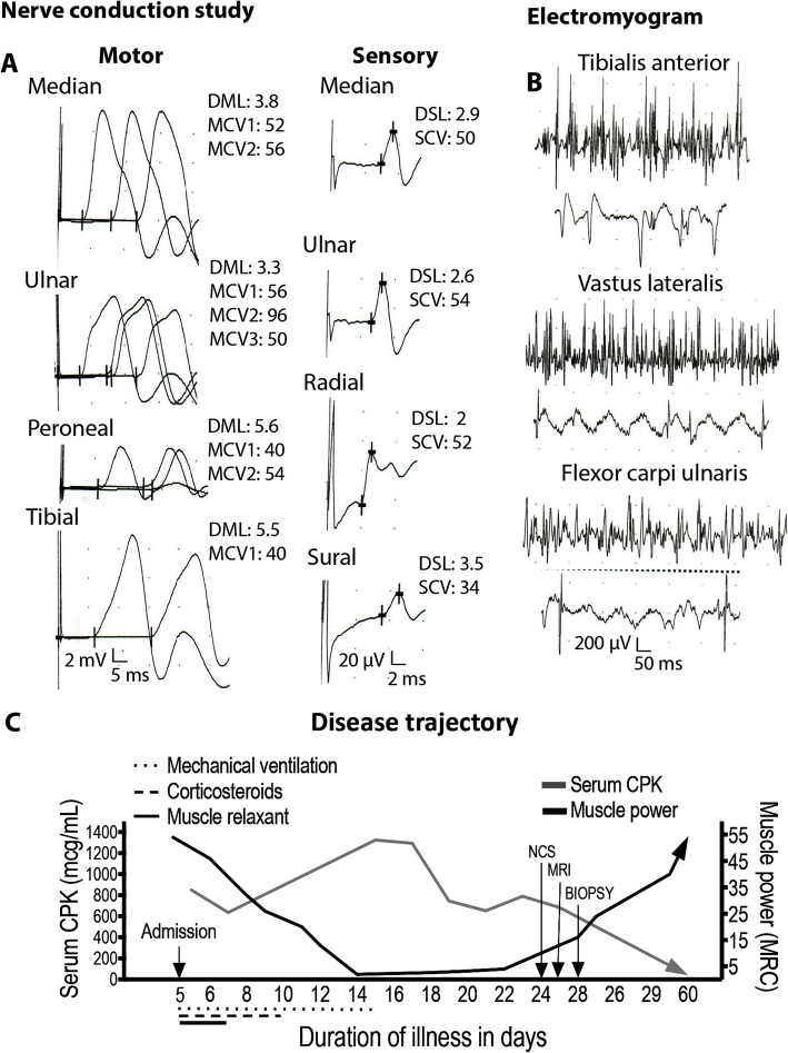 Severe acute myopathy following SARS-CoV-2 infection: a case report and review of recent literature.