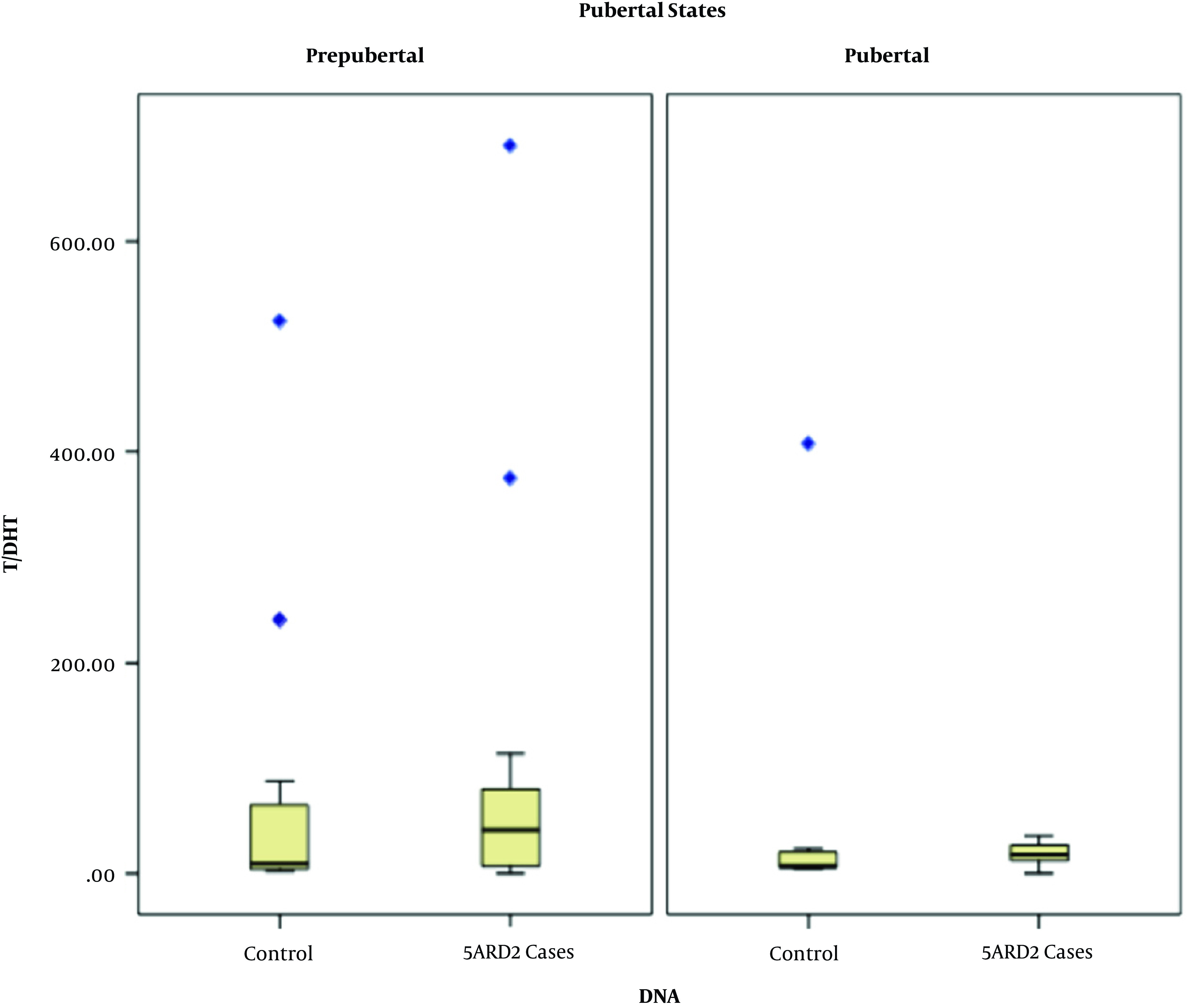 Accuracy of Urinary Etiocholanolone/Androsterone Ratio as Alternative to Serum Testosterone/Dihydrotestosterone Ratio for Diagnosis of 5 Alpha-reductase Type 2 Deficiency Patients and Carriers in Indonesia.