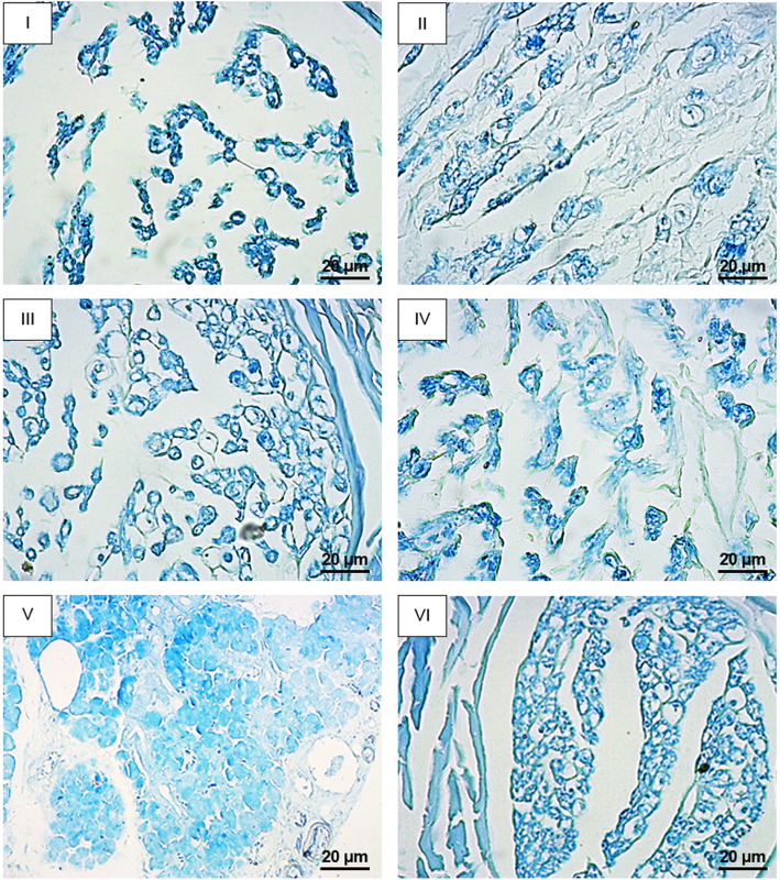 Facial nerve regeneration using silicone conduits filled with ammonia-functionalized graphene oxide and frankincense-embedded hydrogel.