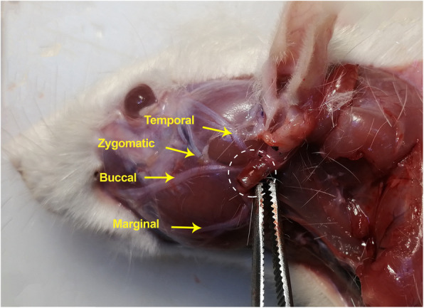 Facial nerve regeneration using silicone conduits filled with ammonia-functionalized graphene oxide and frankincense-embedded hydrogel.