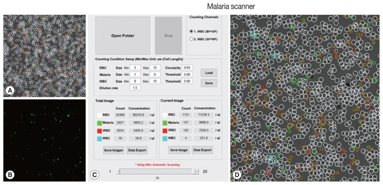 Performance Evaluation of Biozentech Malaria Scanner in Plasmodium knowlesi and P. falciparum as a New Diagnostic Tool.