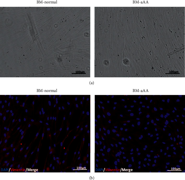 Human Acquired Aplastic Anemia Patients' Bone-Marrow-Derived Mesenchymal Stem Cells Are Not Influenced by Hematopoietic Compartment and Maintain Stemness and Immune Properties.