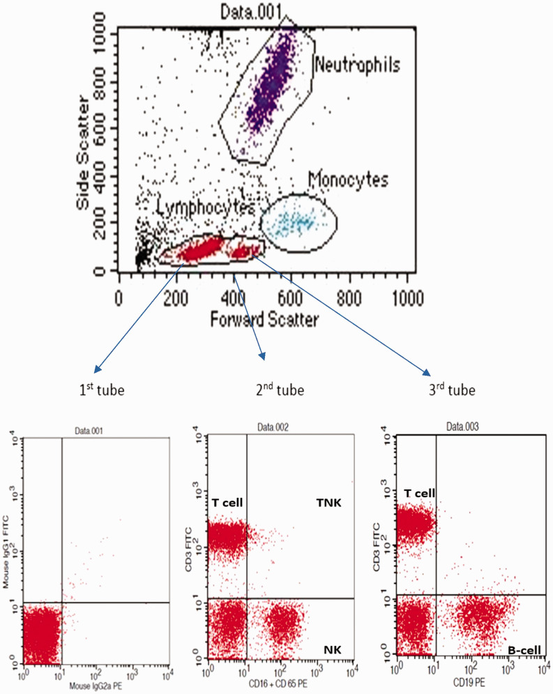 Circulating cell-free DNA, peripheral lymphocyte subsets alterations and neutrophil lymphocyte ratio in assessment of COVID-19 severity.