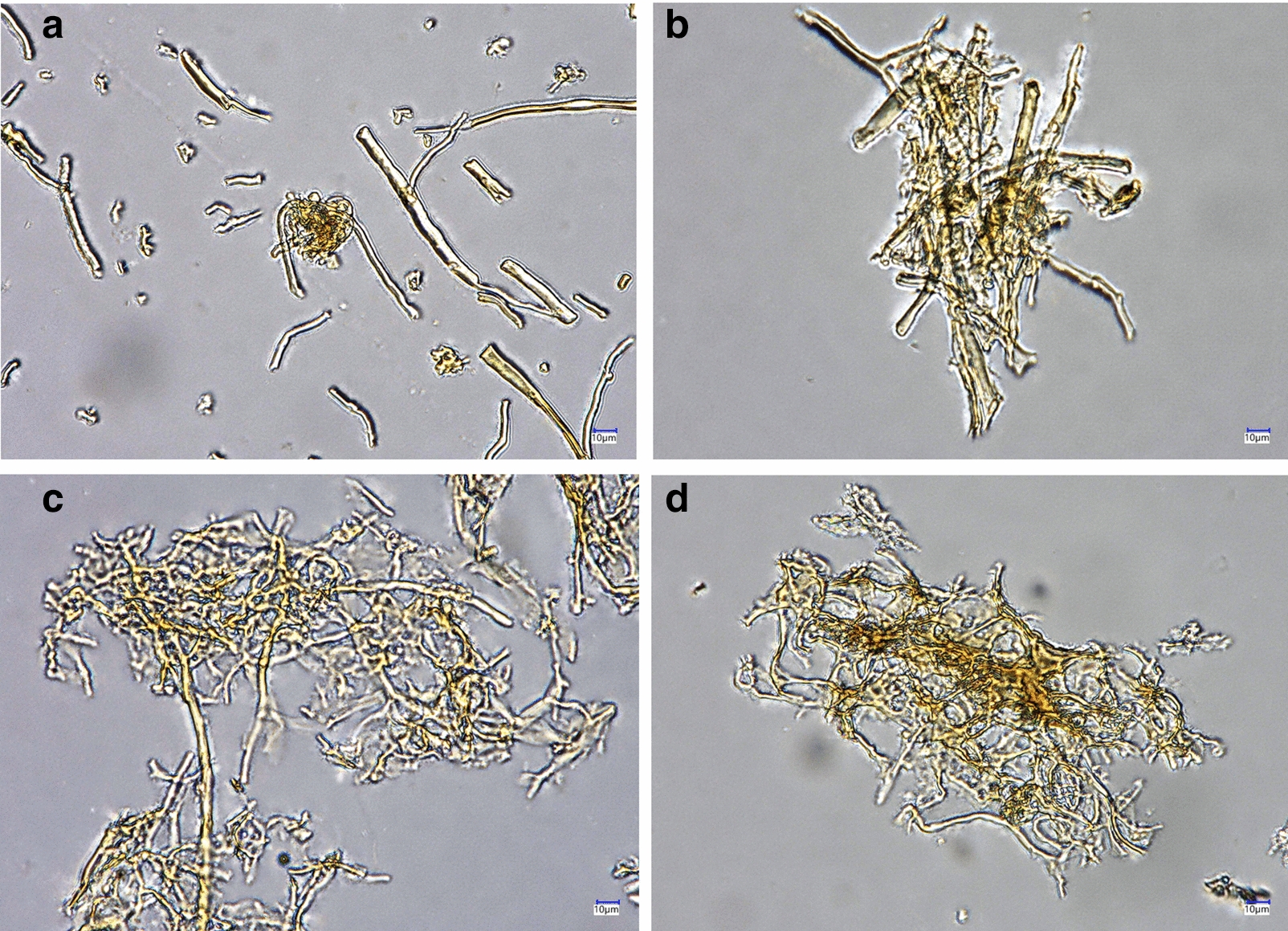 An approach to change the basic polymer composition of the milled Fomes fomentarius fruiting bodies.