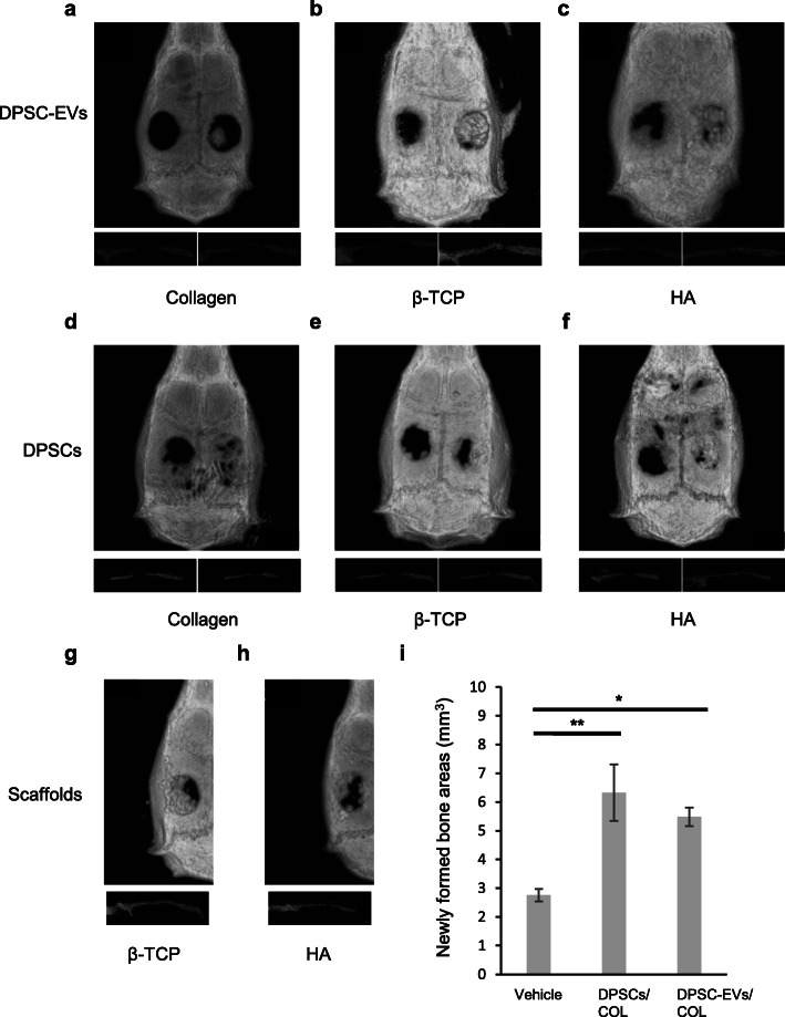 Efficacy of extracellular vesicles from dental pulp stem cells for bone regeneration in rat calvarial bone defects.