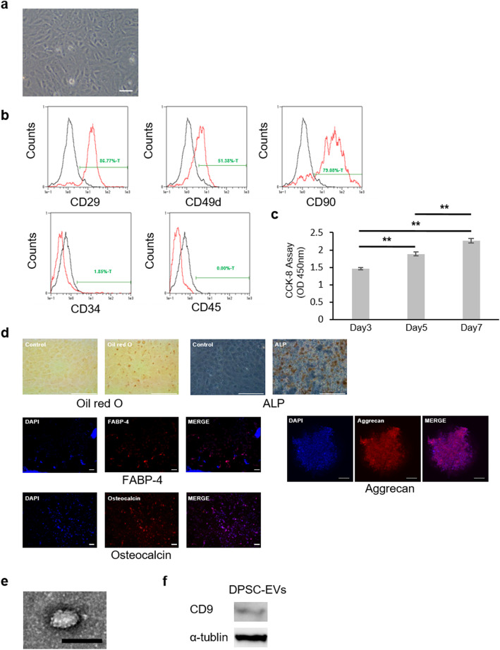 Efficacy of extracellular vesicles from dental pulp stem cells for bone regeneration in rat calvarial bone defects.