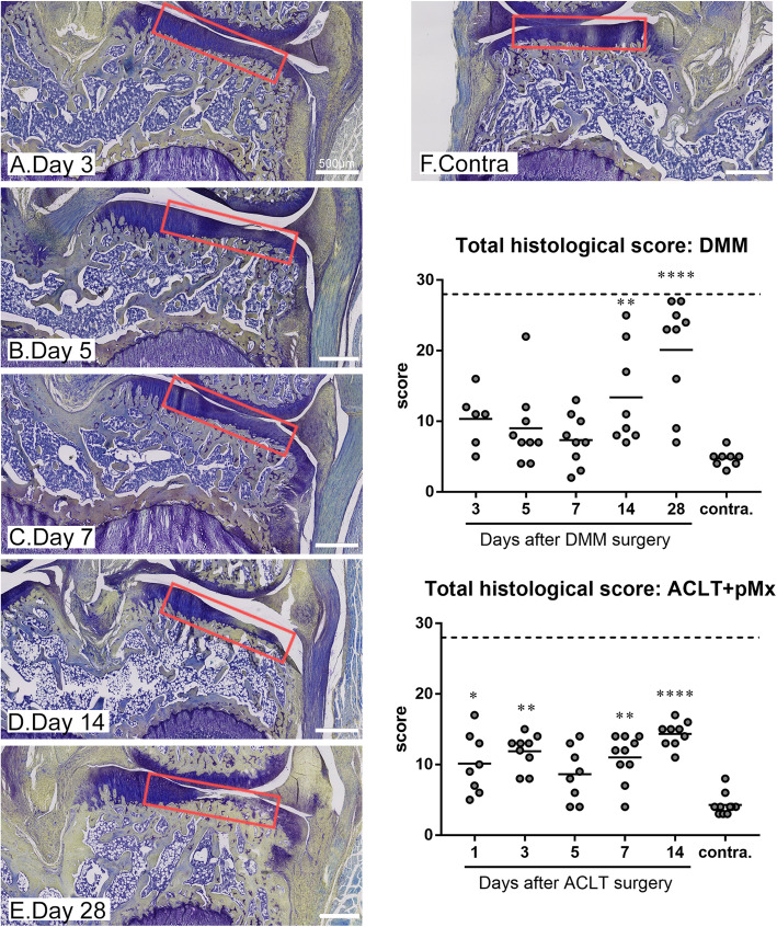 Early detection of osteoarthritis in the rat with an antibody specific to type II collagen modified by reactive oxygen species.