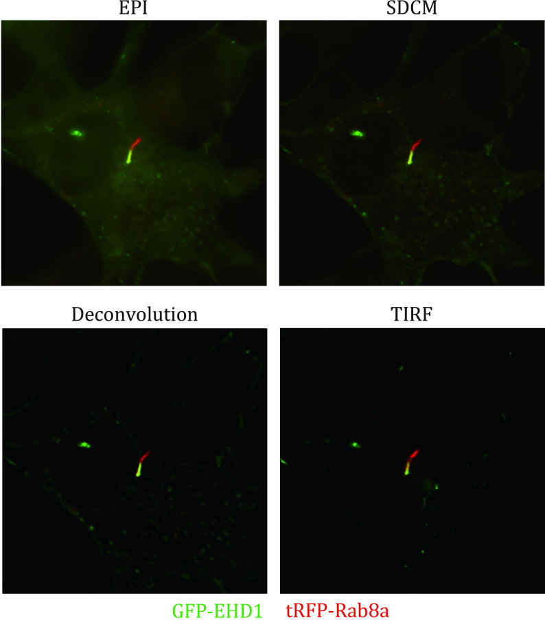 Live-cell fluorescence imaging of ciliary dynamics.