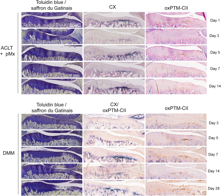 Early detection of osteoarthritis in the rat with an antibody specific to type II collagen modified by reactive oxygen species.