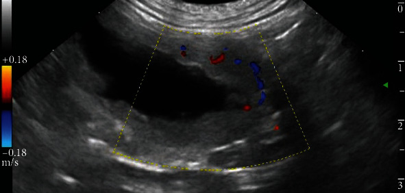 Unilateral Urogenital Disontogeny in a Dog.