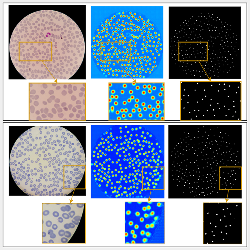 Deep Learning-Based Cell Detection and Extraction in Thin Blood Smears for Malaria Diagnosis.