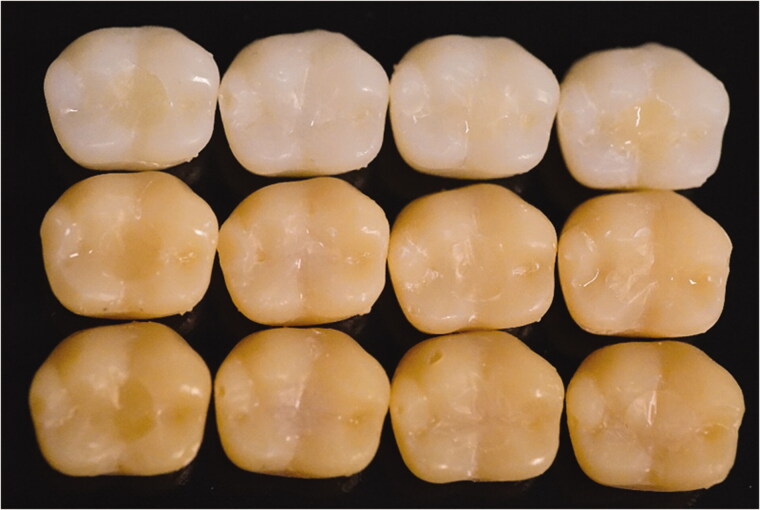 The effect of refractive index of fillers and polymer matrix on translucency and color matching of dental resin composite.