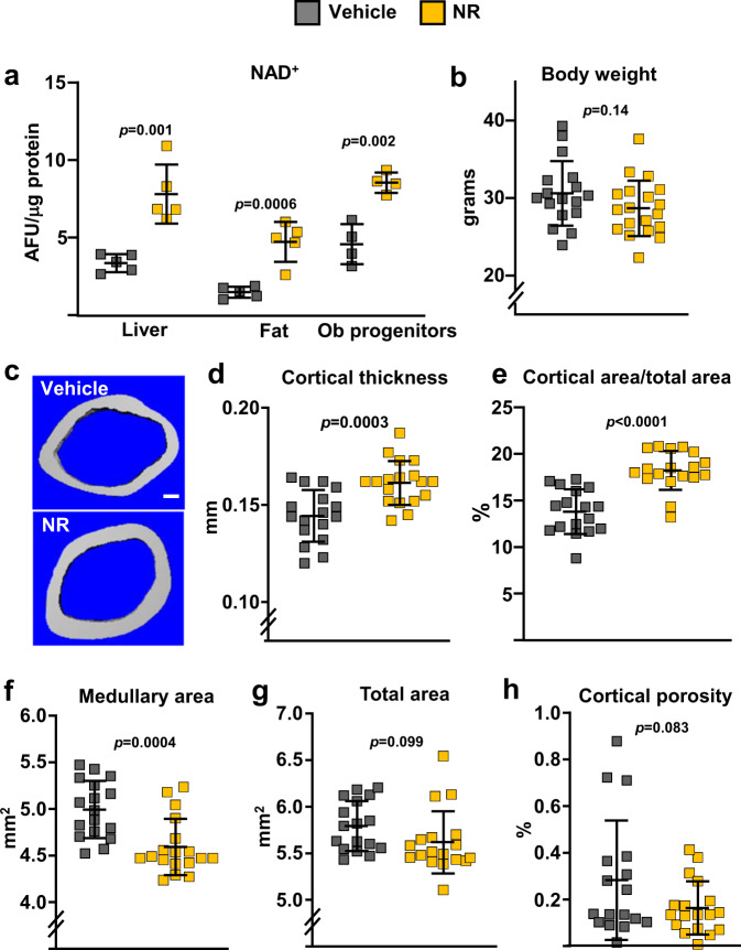 A decrease in NAD<sup>+</sup> contributes to the loss of osteoprogenitors and bone mass with aging.