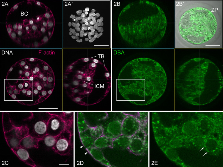 What Cyto- and Histochemistry Can Do to Crack the Sugar Code.