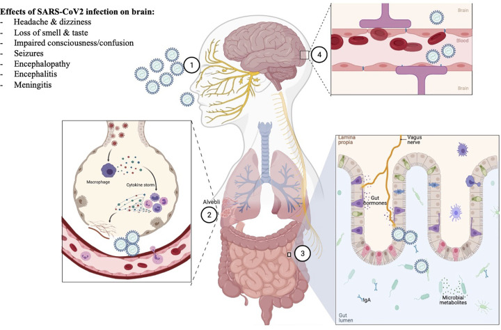 Back to the future: lessons from past viral infections and the link with Parkinson's disease.