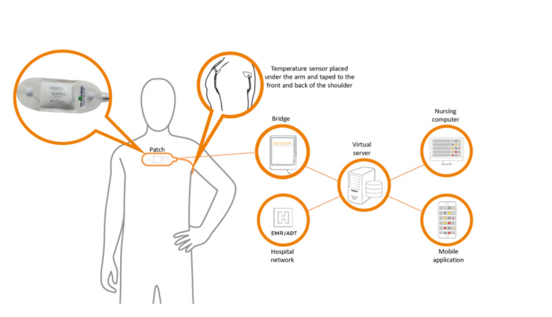 Short-Term Wearable Sensors for In-Hospital Medical and Surgical Patients: Mixed Methods Analysis of Patient Perspectives.