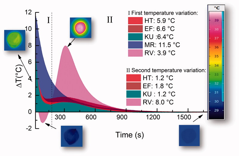 Studies of the early stages of the dynamic setting process of chemically activated restorative glass-ionomer cements.