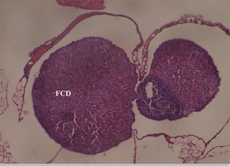 Xylopia aethiopica ethanol seed extract suppresses Cadmium chloride-induced ovary and gonadotropins toxicity in adult female Wistar rats.