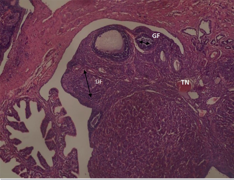 Xylopia aethiopica ethanol seed extract suppresses Cadmium chloride-induced ovary and gonadotropins toxicity in adult female Wistar rats.