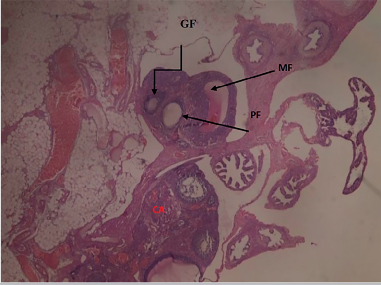 Xylopia aethiopica ethanol seed extract suppresses Cadmium chloride-induced ovary and gonadotropins toxicity in adult female Wistar rats.