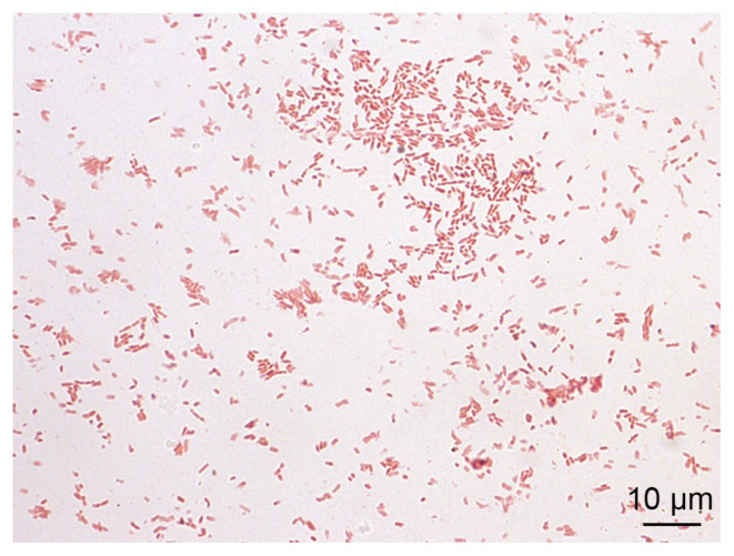 Ignatzschineria larvae Bacteremia Following Lucilia sp. Myiasis in an Irregular Migrant: A Case Report.