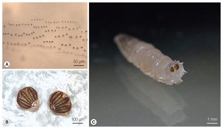 Ignatzschineria larvae Bacteremia Following Lucilia sp. Myiasis in an Irregular Migrant: A Case Report.