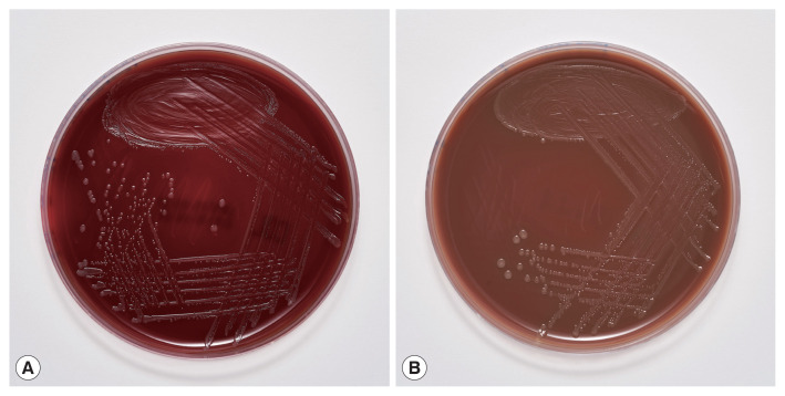 Ignatzschineria larvae Bacteremia Following Lucilia sp. Myiasis in an Irregular Migrant: A Case Report.