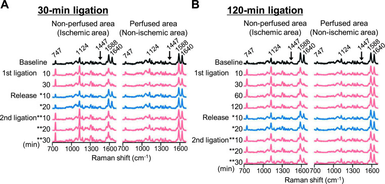 Raman Spectroscopic Assessment of Myocardial Viability in Langendorff-Perfused Ischemic Rat Hearts.