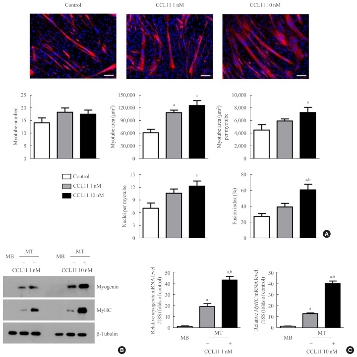 Effect of CCL11 on In Vitro Myogenesis and Its Clinical Relevance for Sarcopenia in Older Adults.
