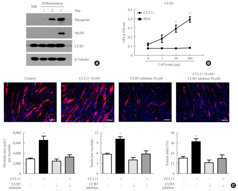 Effect of CCL11 on In Vitro Myogenesis and Its Clinical Relevance for Sarcopenia in Older Adults.