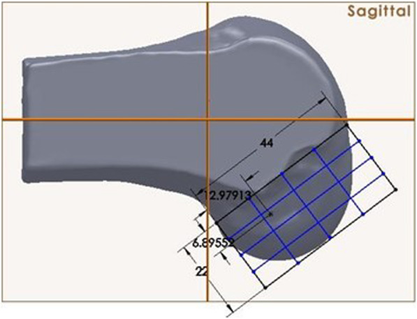 Anterior cruciate ligament femoral-tunnel drilling through an anteromedial portal: 3-dimensional plane drilling angle affects tunnel length relative to notchplasty.