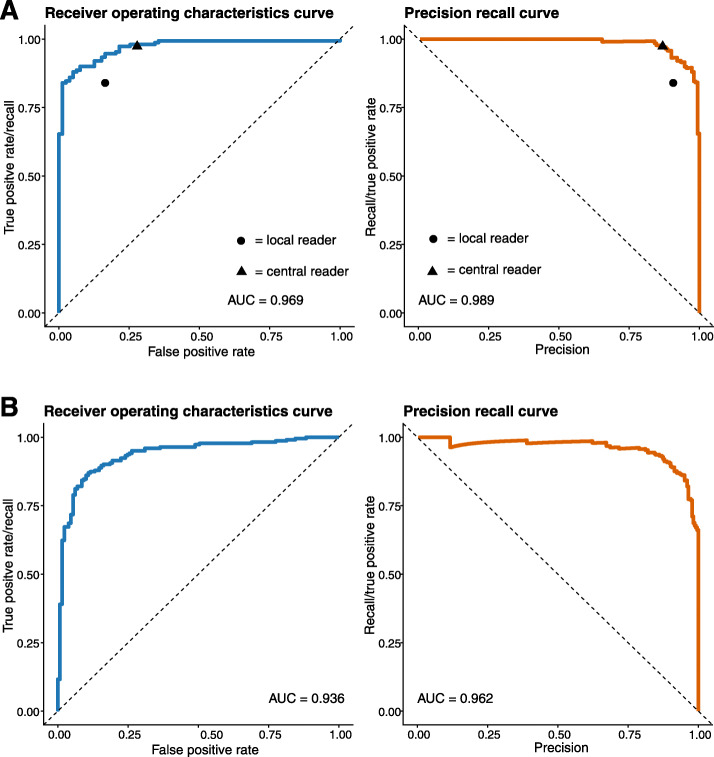 Deep learning for detection of radiographic sacroiliitis: achieving expert-level performance.