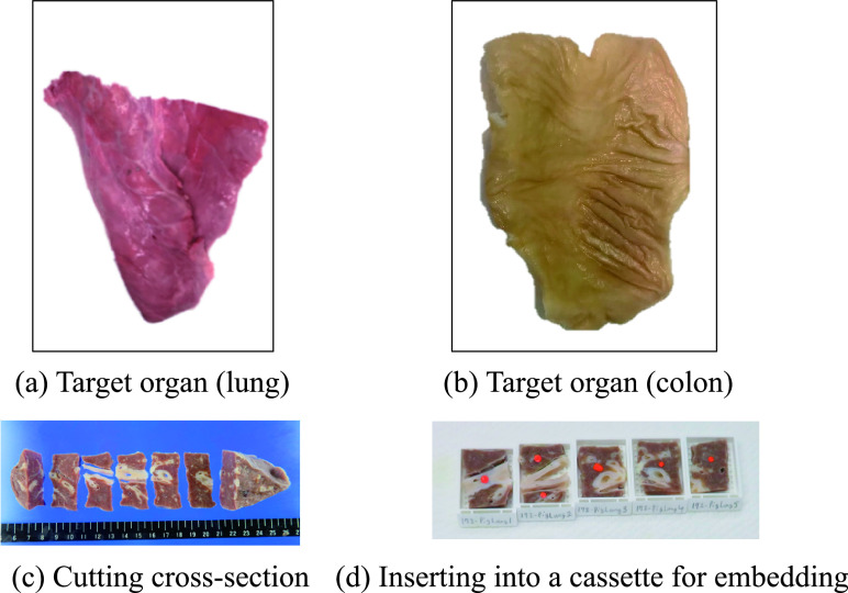 Development of Pathological Diagnosis Support System Using Micro-computed Tomography.