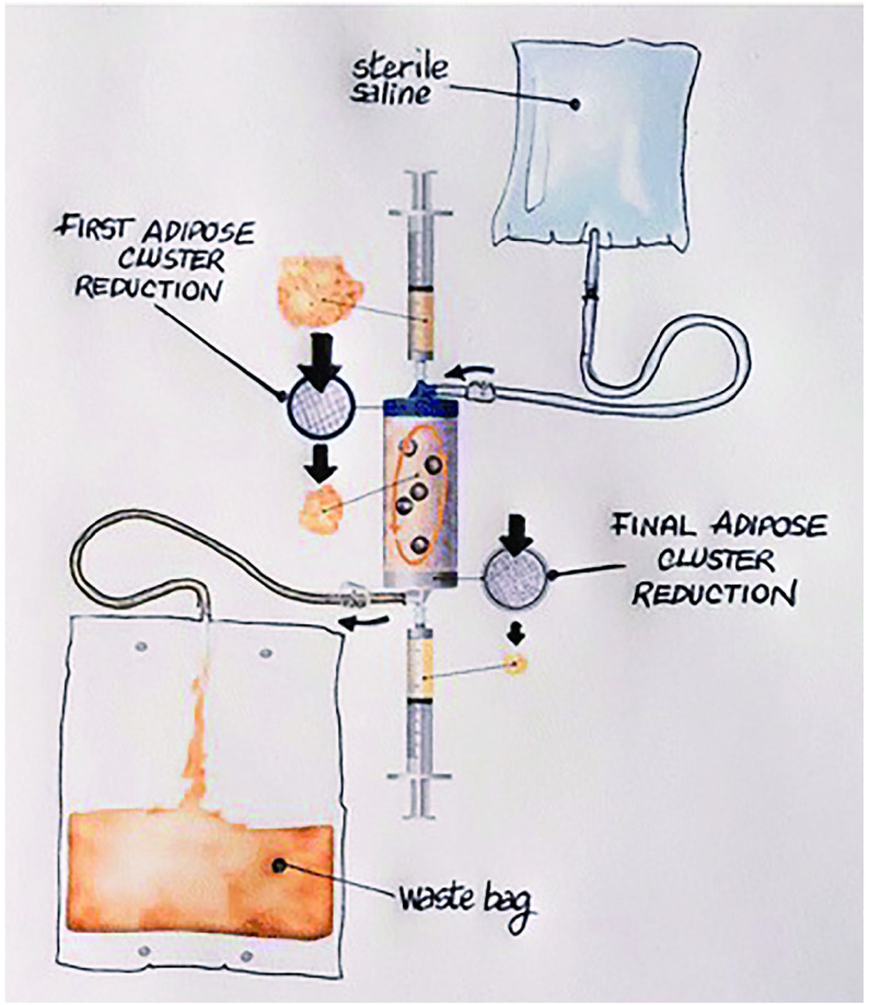 Potential of adipose derived stem cell preparations in neurological repair and regeneration.