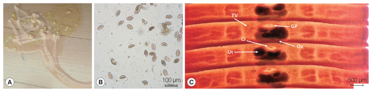 First Clinical Cases of Spirometrosis in Two Cats in Korea.