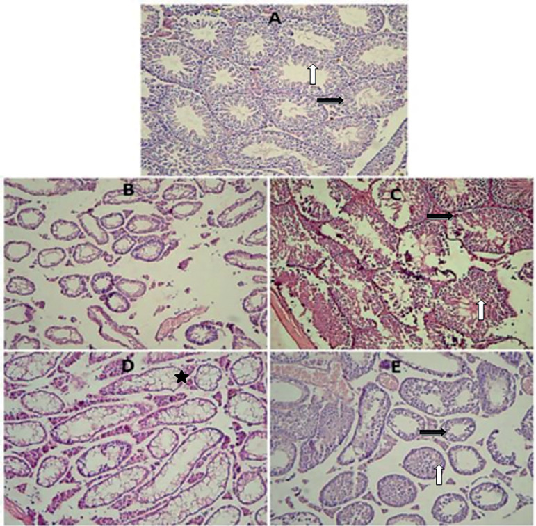 The effects of ozone and melatonin on busulfan-induced testicular damage in mice.