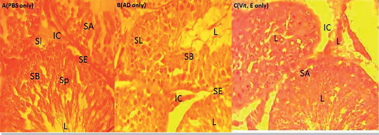 Aqueous Extract of Adansonia digitata reversed Cotton Seed Extract-Induced Testicular Damage in Wistar rats.