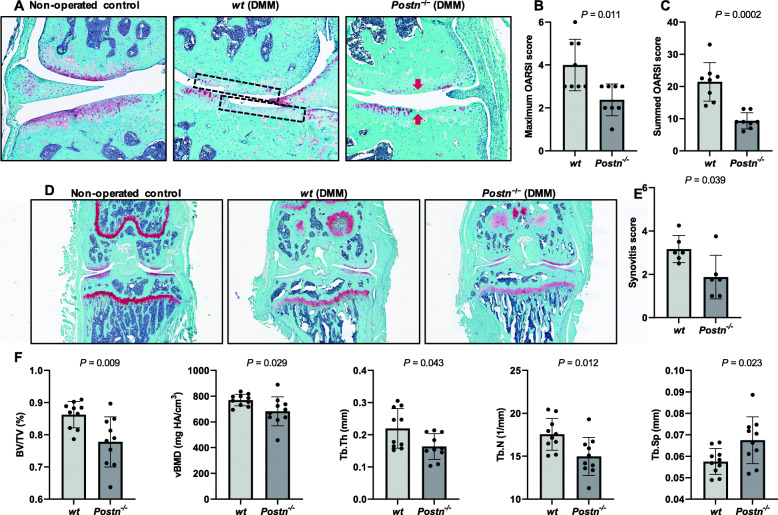 Periostin loss-of-function protects mice from post-traumatic and age-related osteoarthritis.