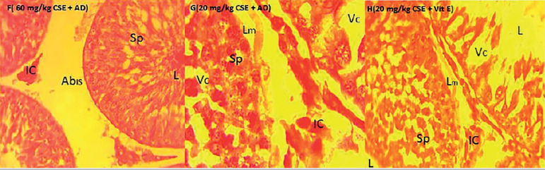 Aqueous Extract of Adansonia digitata reversed Cotton Seed Extract-Induced Testicular Damage in Wistar rats.