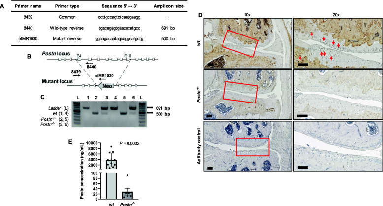 Periostin loss-of-function protects mice from post-traumatic and age-related osteoarthritis.