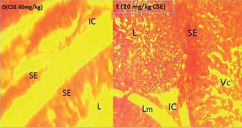 Aqueous Extract of Adansonia digitata reversed Cotton Seed Extract-Induced Testicular Damage in Wistar rats.
