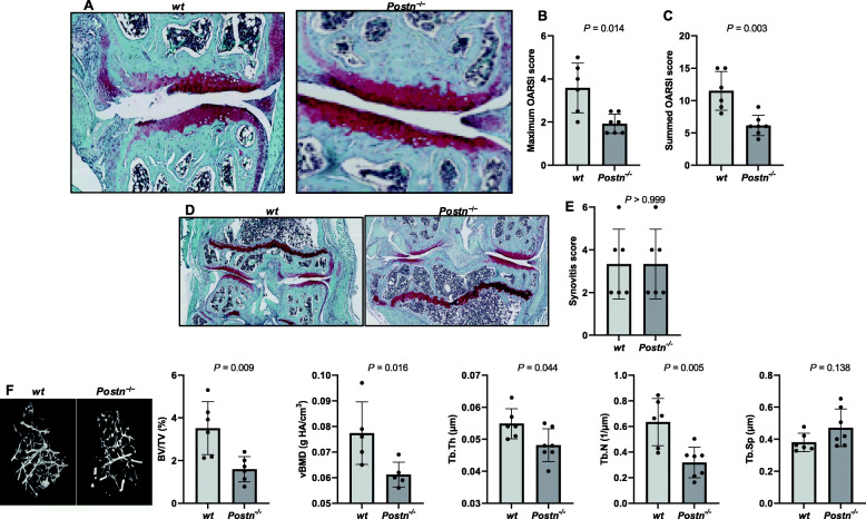 Periostin loss-of-function protects mice from post-traumatic and age-related osteoarthritis.