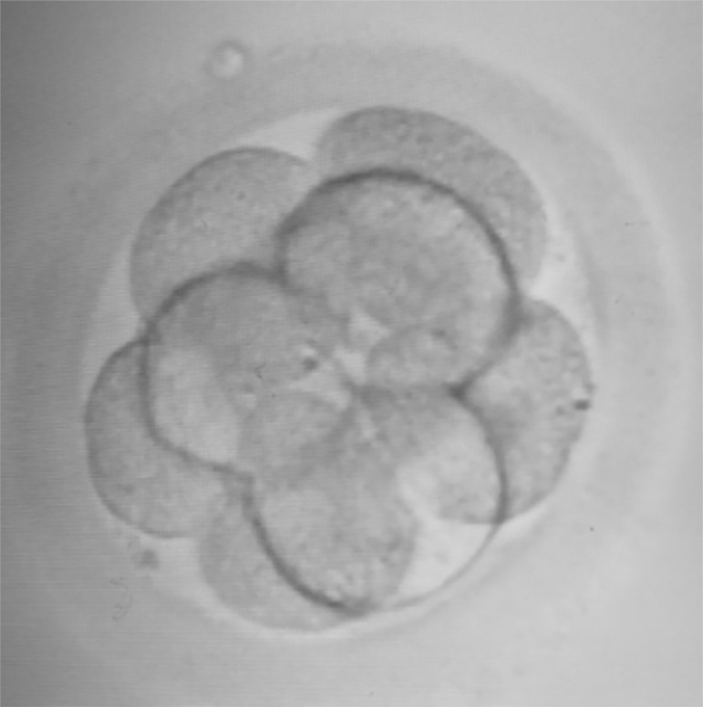 One follicle, one egg, one embryo: a case-report of successful pregnancy obtained from a single oocyte collected.